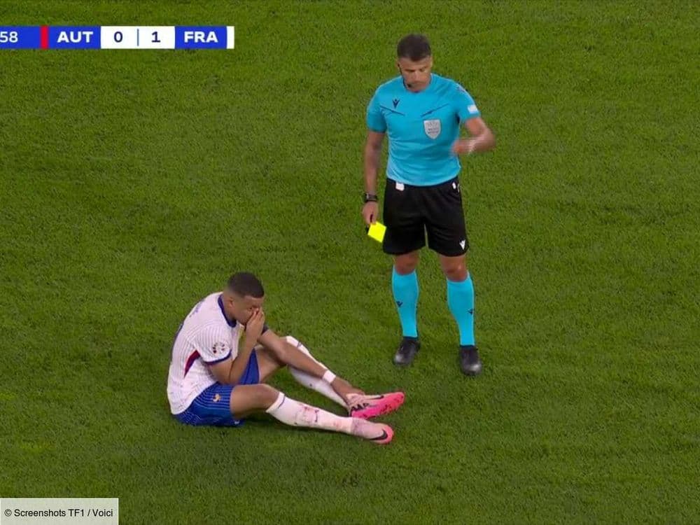 Euro 2024 : le nez en sang, Kylian Mbappé reçoit un carton jaune, les internautes ne comprennent pas pourquoi