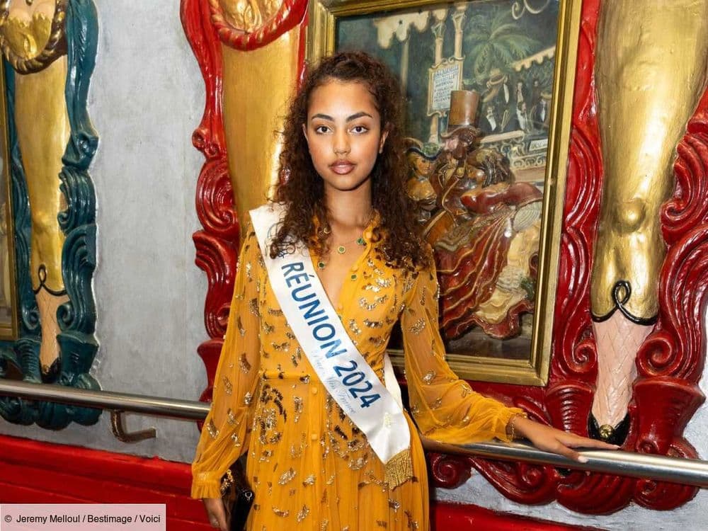 "Je n'en ai pas parlé" : Miss Réunion 2024 révèle pourquoi elle a caché sa blessure durant le voyage de préparation de Miss France 2025