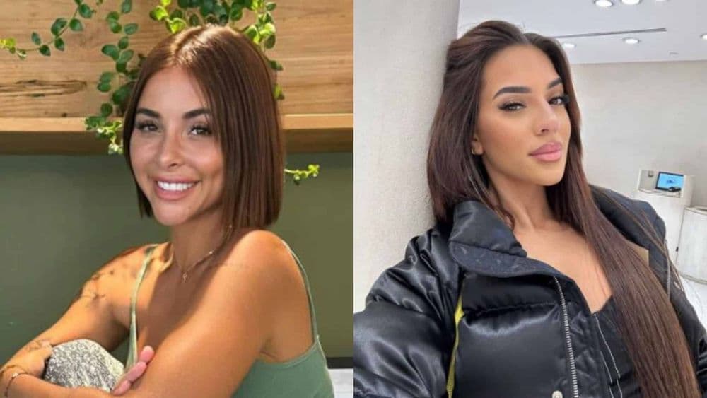 "Je m'en t..." : Rym Renom accusée d'avoir refait son visage, Marwa Merazka réagit cash à sa dernière chirurgie !