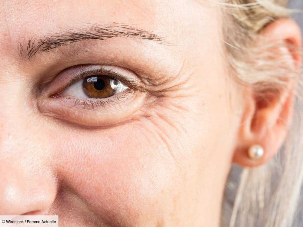 Quelle est la différence entre rides et ridules et comment les atténuer ? Des dermatologues répondent
