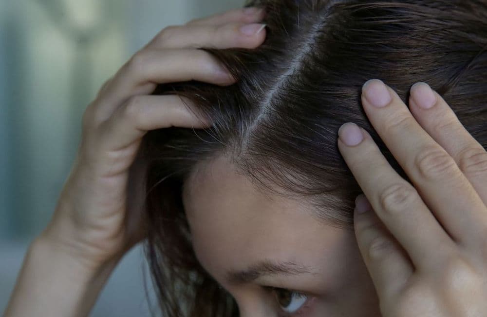 Pourquoi les 20-30 ans ont-ils des cheveux blancs de plus en plus tôt ?