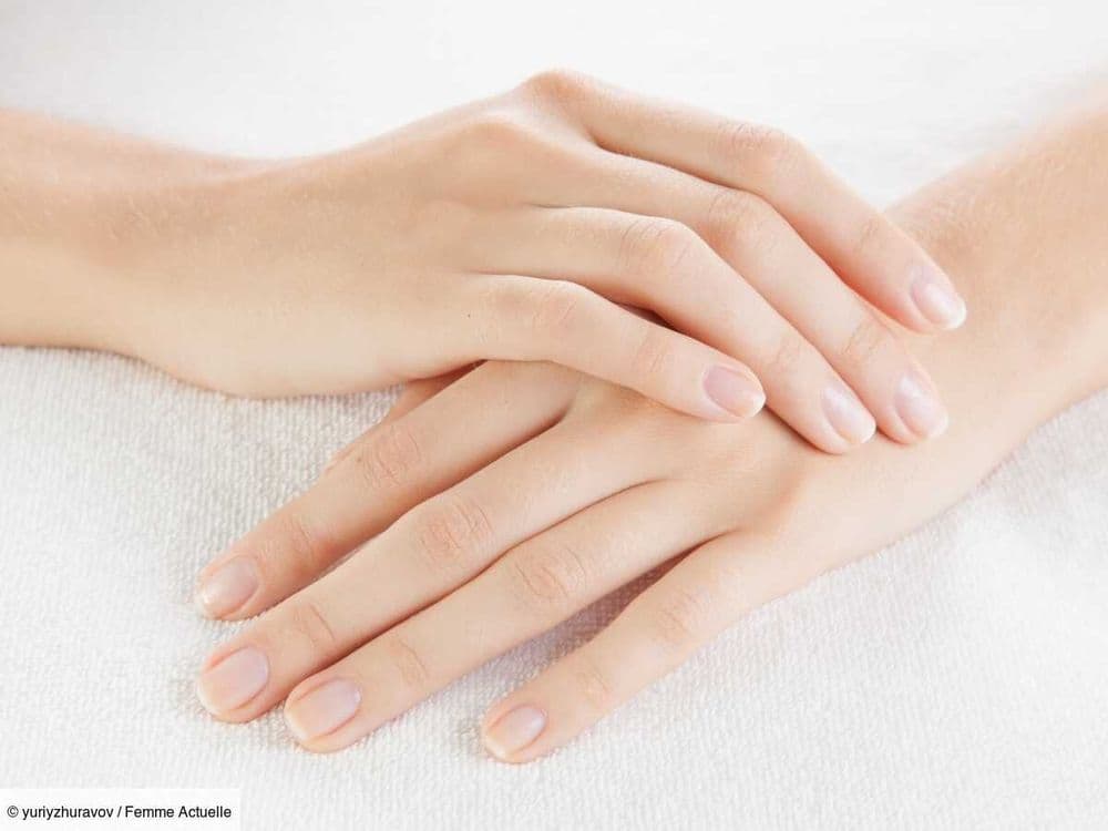 De la peau pousse sous votre ongle ? C'est peut-être dû à ces mauvaises habitudes