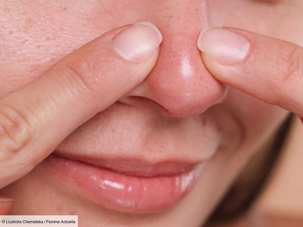 Points noirs et filaments sébacés : une dermatologue nous dévoile les produits à utiliser pour s'en débarrasser