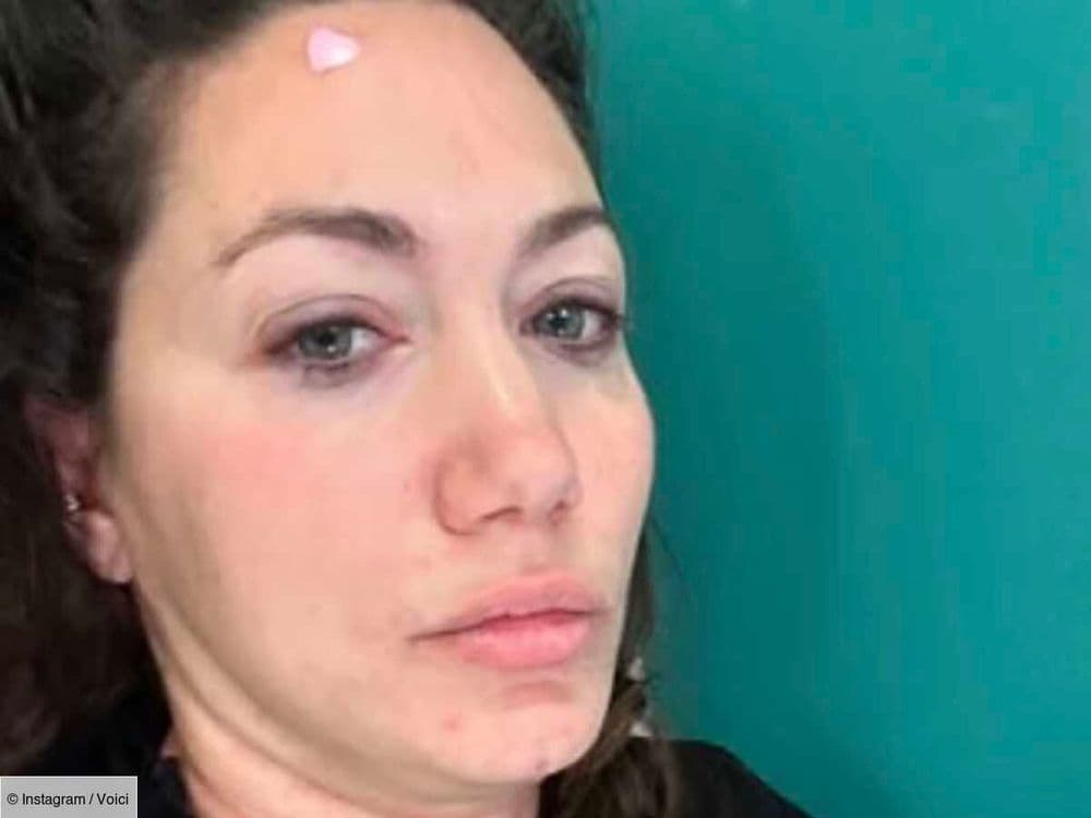 "Ça aurait pu être mortel" : Louise Chabat frôle la mort, elle raconte son calvaire sur Instagram