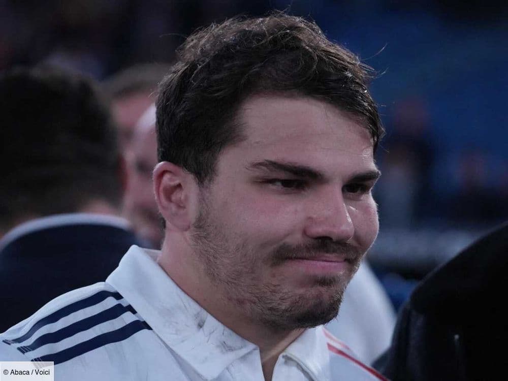 “Il ne pourra pas revenir” : Antoine Dupont blessé, cette décision lourde de conséquence pour le sportif