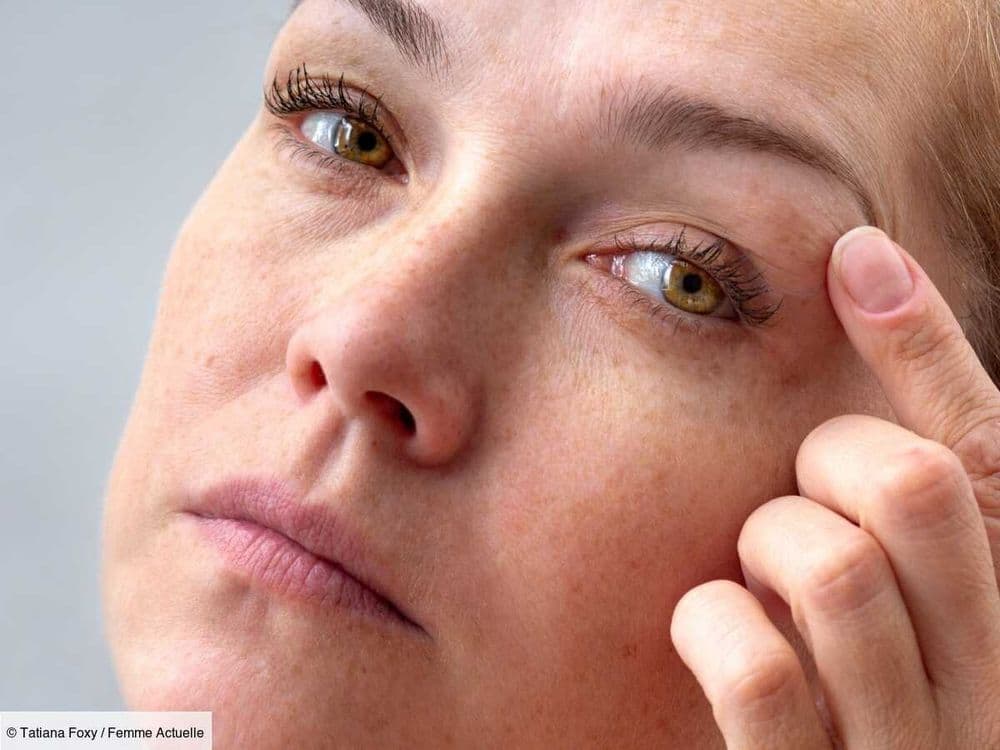 Pourquoi vos paupières sont-elles sèches ? Voici les 3 raisons inattendues, selon une dermatologue