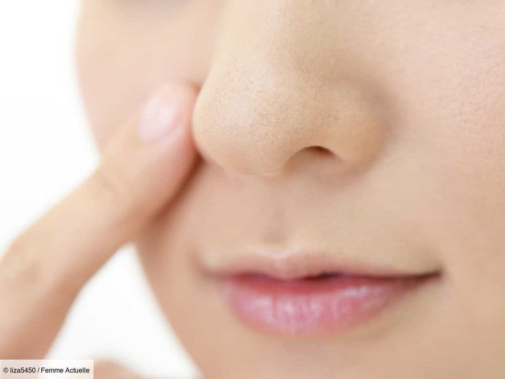 Filaments sébacés sur le nez : la routine d'une dermatologue pour en venir à bout