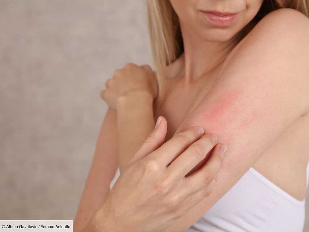 Ménopause : une dermatologue partage ses conseils pour hydrater une peau sèche et irritée en profondeur
