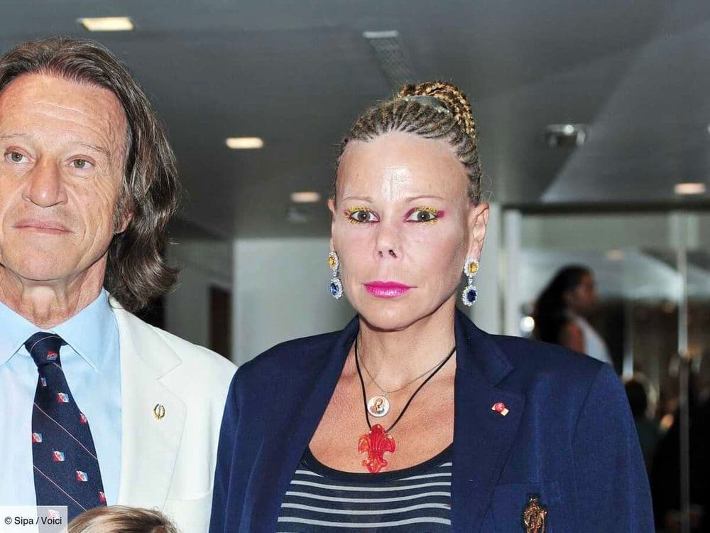 Kalina de Bulgarie : la princesse a-t-elle été victime d'une chirurgie ratée au nez ? Son mari répond aux rumeurs