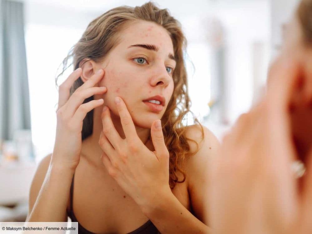 Le rétinol me donne des boutons, dois-je arrêter ou persévérer ? Une dermatologue explique les signes à prendre en compte