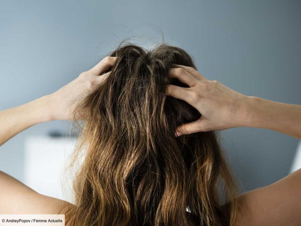 Démangeaisons du cuir chevelu : quel shampoing utiliser pour apaiser le cuir chevelu ?
