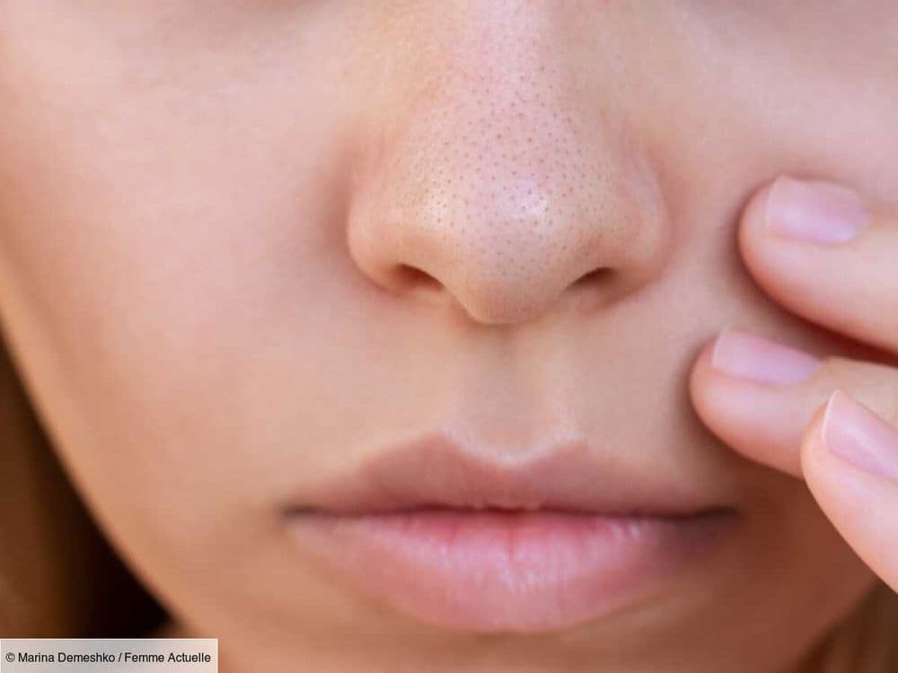 Pores dilatés sur le nez : un dermatologue dévoile les produits à utiliser pour lisser le grain de peau