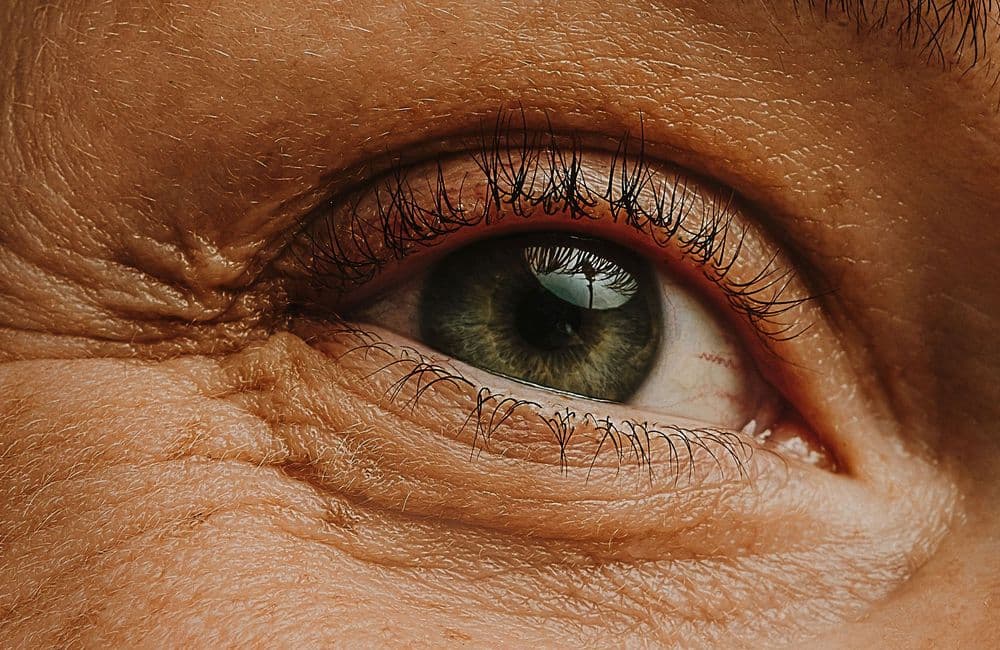 La greffe de sourcils, comment ça marche ?