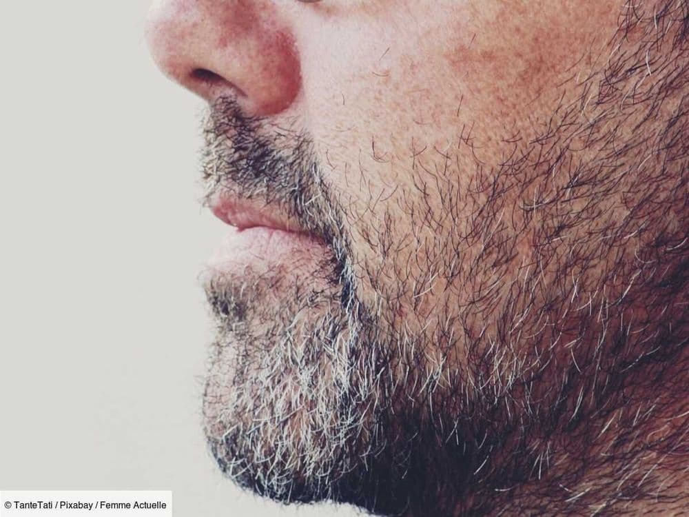 Il a le visage le plus poilu au monde : atteint du syndrome du loup-garou, cet Indien entre dans le Guinness des records