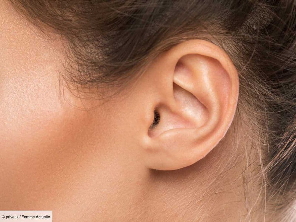 Points noirs dans les oreilles : d’où viennent-ils et comment s’en débarrasser ?