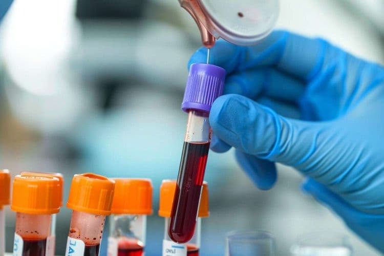 L’agence américaine autorise un premier test sanguin destiné au diagnostic de la maladie d’Alzheimer