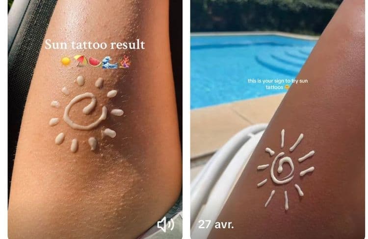Tatouage solaire : la dangereuse tendance de l’été sur TikTok