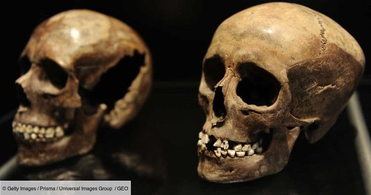 On sait pourquoi les hommes préhistoriques étaient moins sujets aux caries