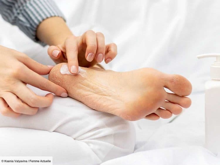 Pieds secs, talons craquelés : voici la routine express d'une dermatologue pour retrouver des pieds tout doux