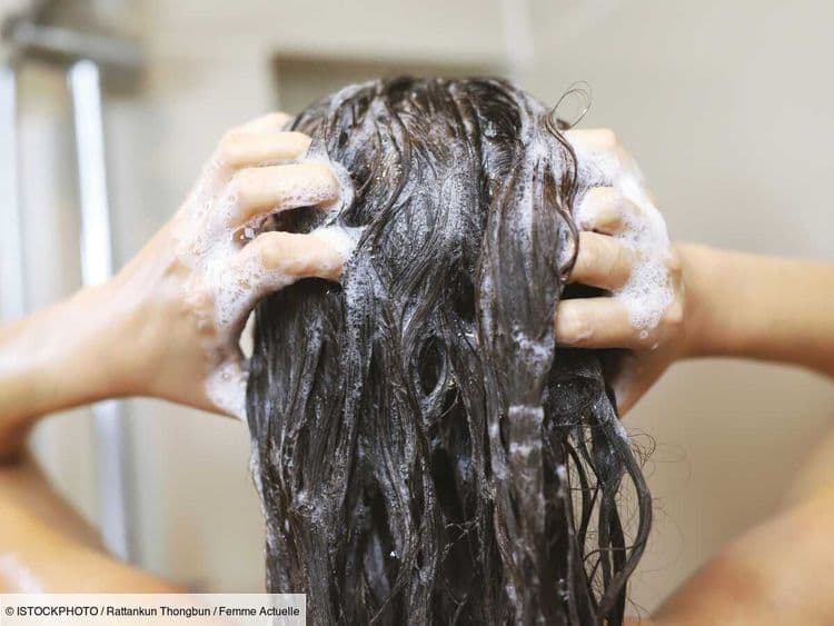 Votre cuir chevelu est sec ? Voici comment l'hydrater sans rendre vos cheveux gras