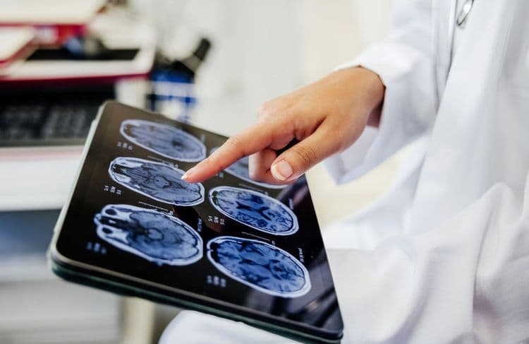 Le cerveau des psychopathes a une particularité, selon cette étude