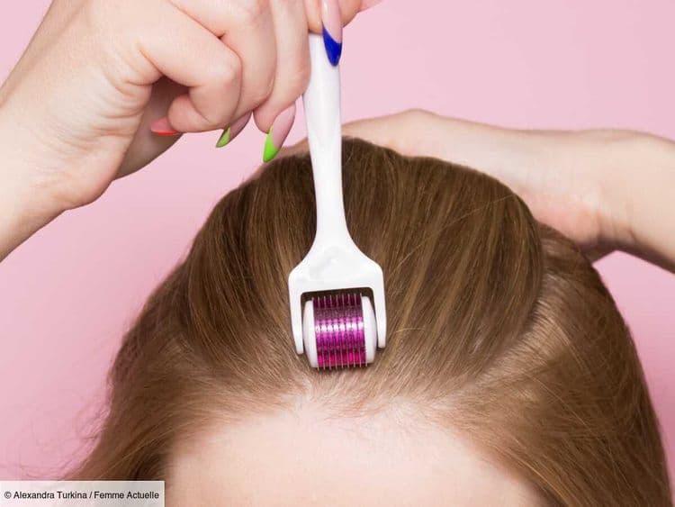 Comment utiliser un dermaroller correctement pour gagner en densité capillaire ? Les conseils d'une dermatologue