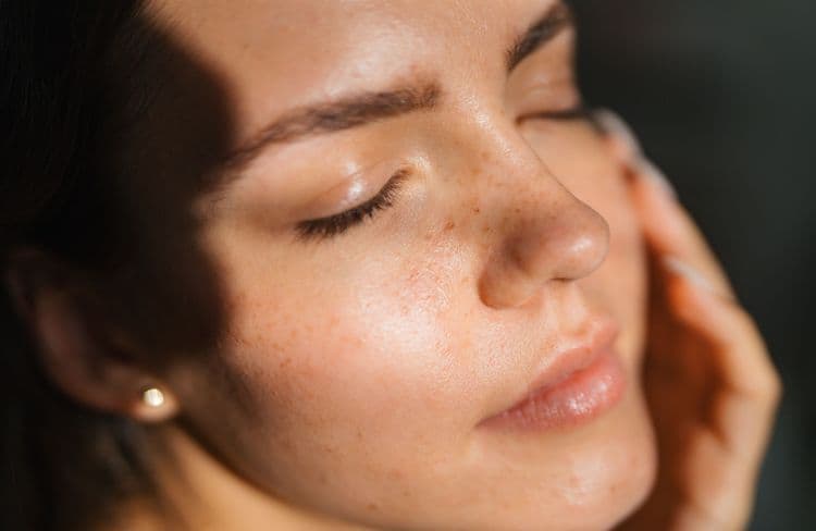 Ces signes souvent ignorés qui montrent que vous avez la peau sensible
