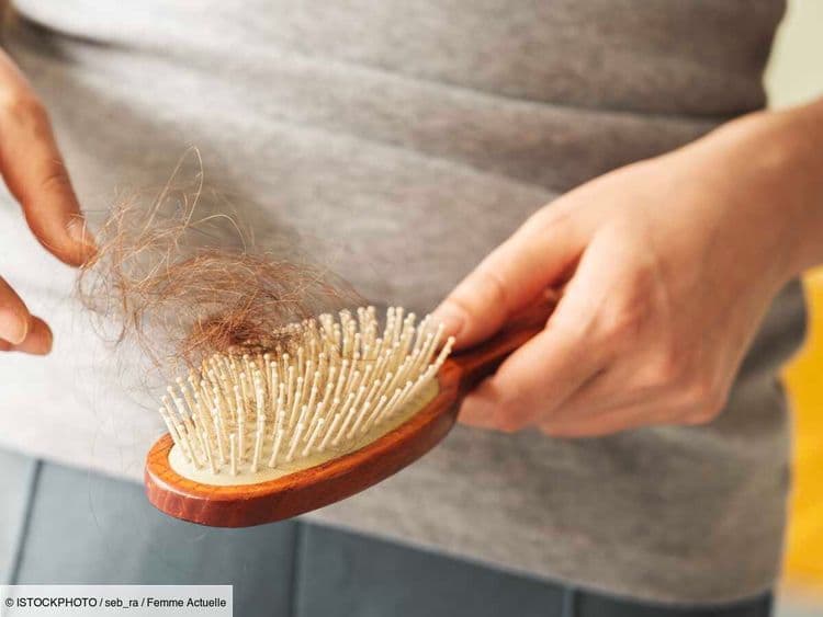 Peut-on stopper la perte de cheveux à la ménopause ? Les conseils d'une dermatologue