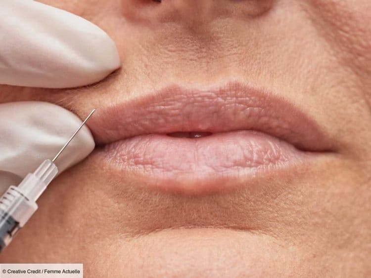 "Cette boule me rappelait chaque jour ce que j’avais vécu" : le témoignage de Marie, victime d'une injection esthétique illégale