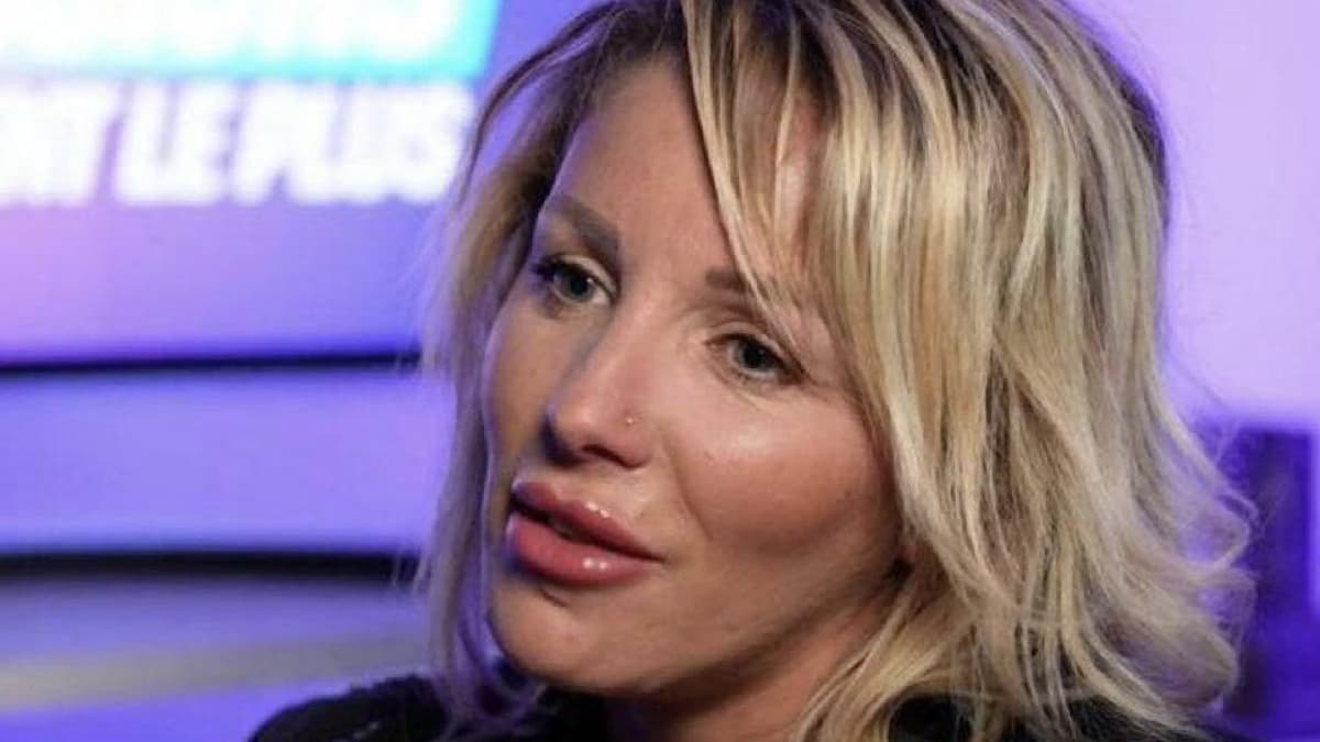Myriam Abel gonflée par des injections au visage : « j’avoue que cette photo fait flipper »